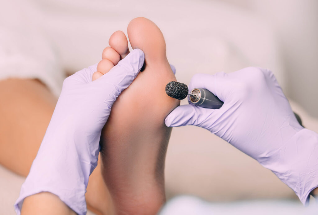 Chiropodist treating a patient's foot, pedicure treatment